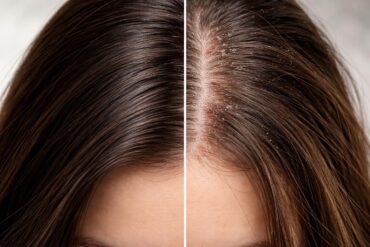 découvrez les effets secondaires potentiels du lashilé good hair sur la santé de vos cheveux et comment en prendre soin efficacement.