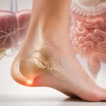 découvrez comment prévenir les douleurs liées à l'épine calcanéenne en adoptant des habitudes bénéfiques pour le foie et l'intestin. conseils pratiques pour un bien-être optimal.